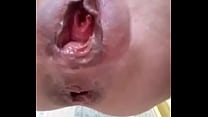 Ruined pussy attempts the most extreme peehole insertion I have ever seen