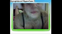 treepcam