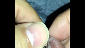 Urethral dilation 9mm plug