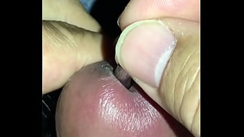 Urethral dilation 9mm plug