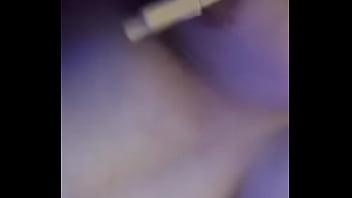 Chubby boy with sore areolas