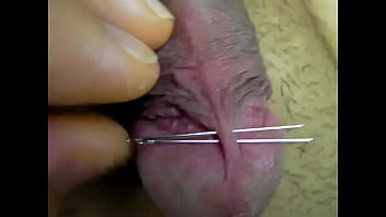 Penis