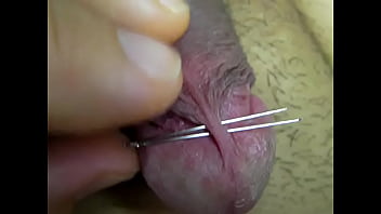 Penis