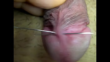 Penis
