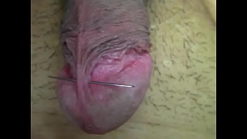 Penis