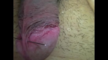 Penis