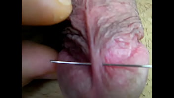 Penis
