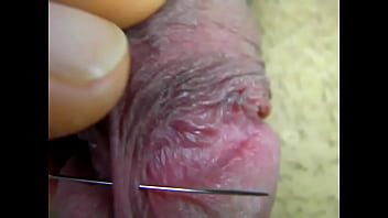 Penis