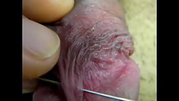 Penis