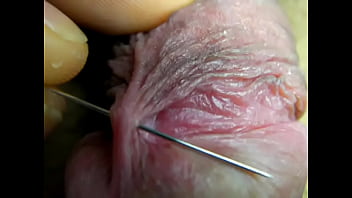 Penis