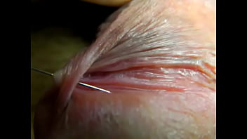 Penis