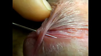 Penis