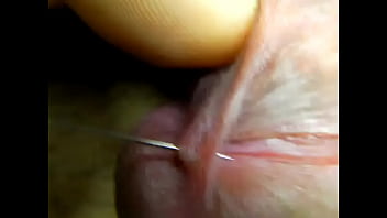 Penis