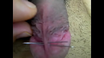 Penis