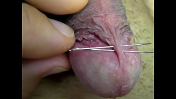 Penis
