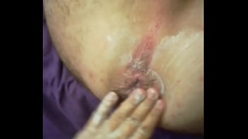 thumb girlfriend fist  ing my asshole   