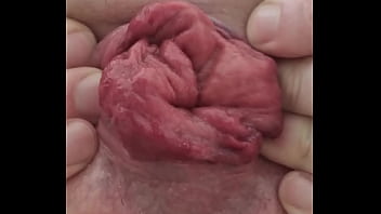 thumb rosebud with se  lffuck  