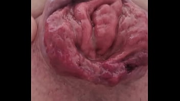 thumb rosebud with se  lffuck  