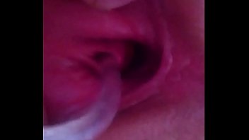thumb catheter love   