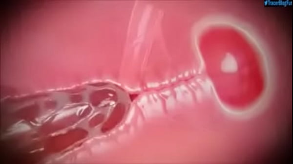 Vídeo