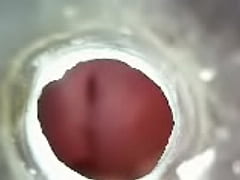  - Inside my urethra