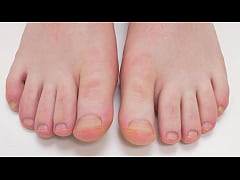  - Feet